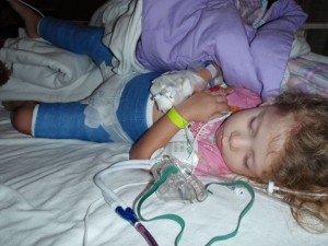 Riley asleep with her cast complete